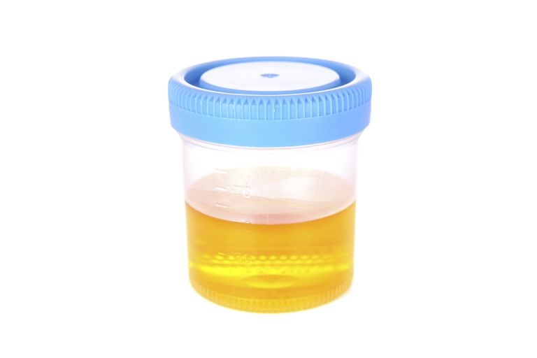 Synthetic Urine 
      Pocket Garfield Ridge Chicago IL